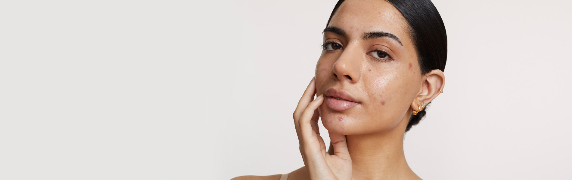 Blemish prone collection header