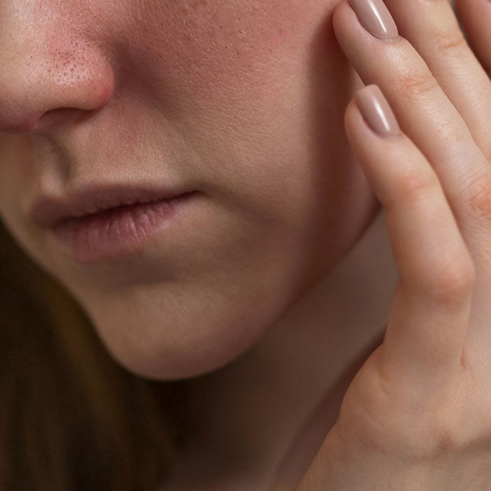 Lower portion of a womans face with her hands touching her cheek.