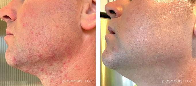 Real Customer Results