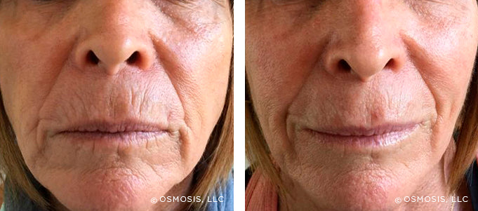 Real Customer Results