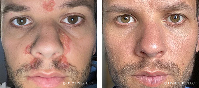 Real Customer Results
