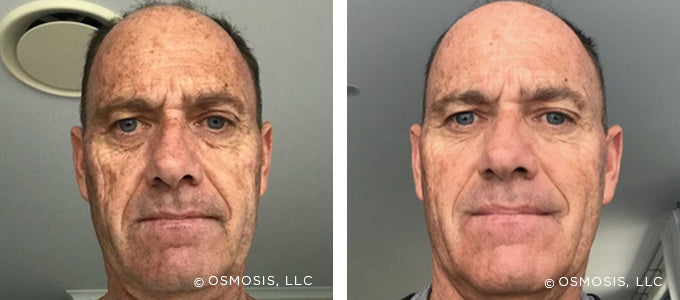 Real Customer Results