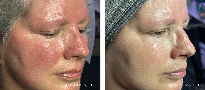 Real Customer Results
