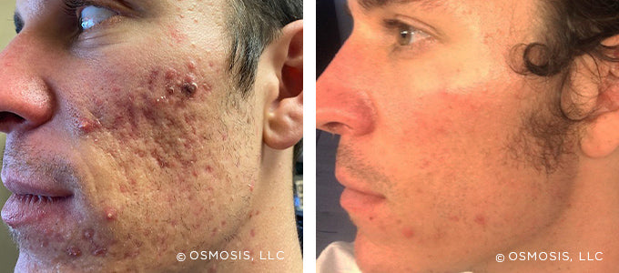 Real Customer Results